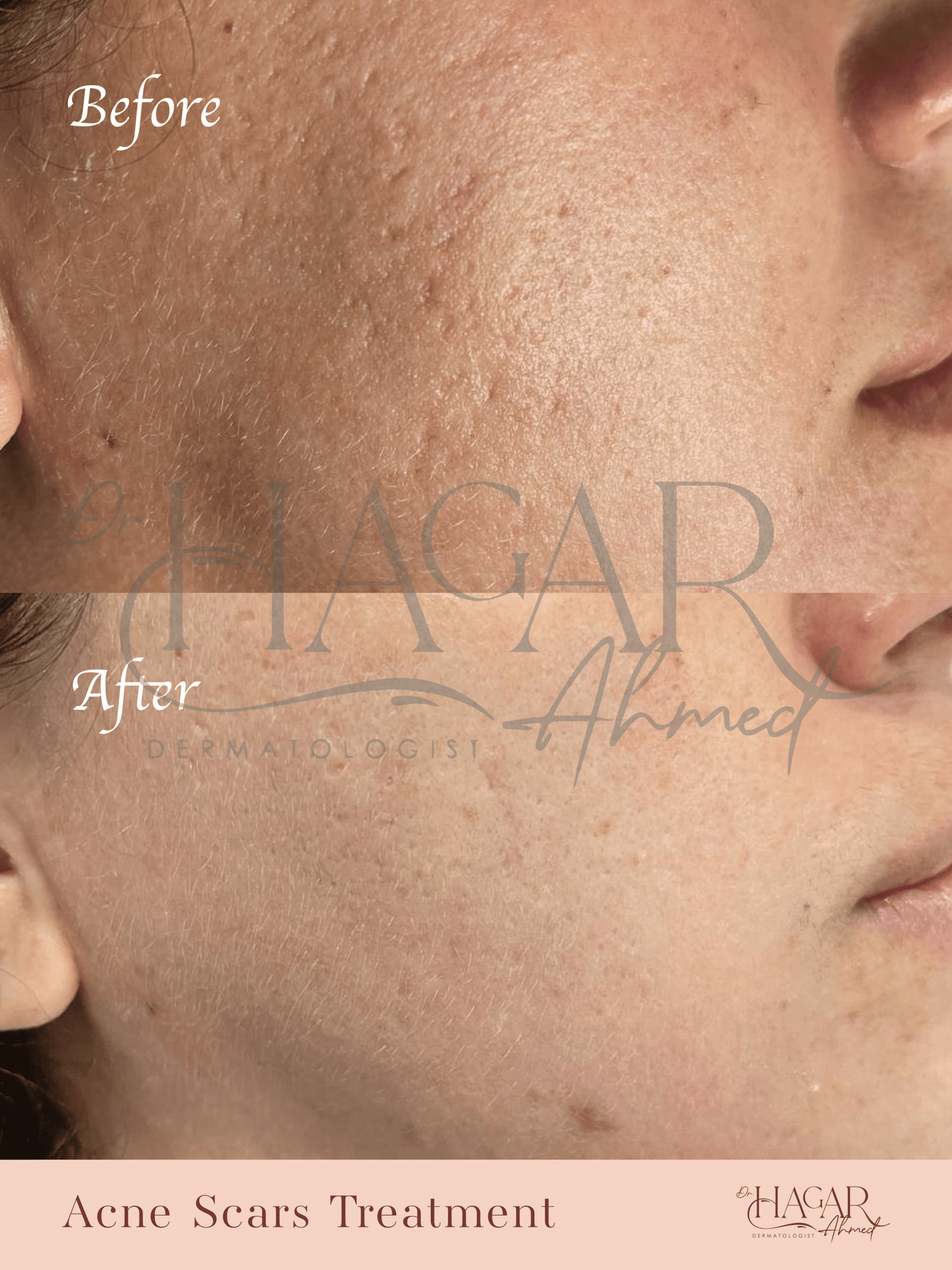 hager-03