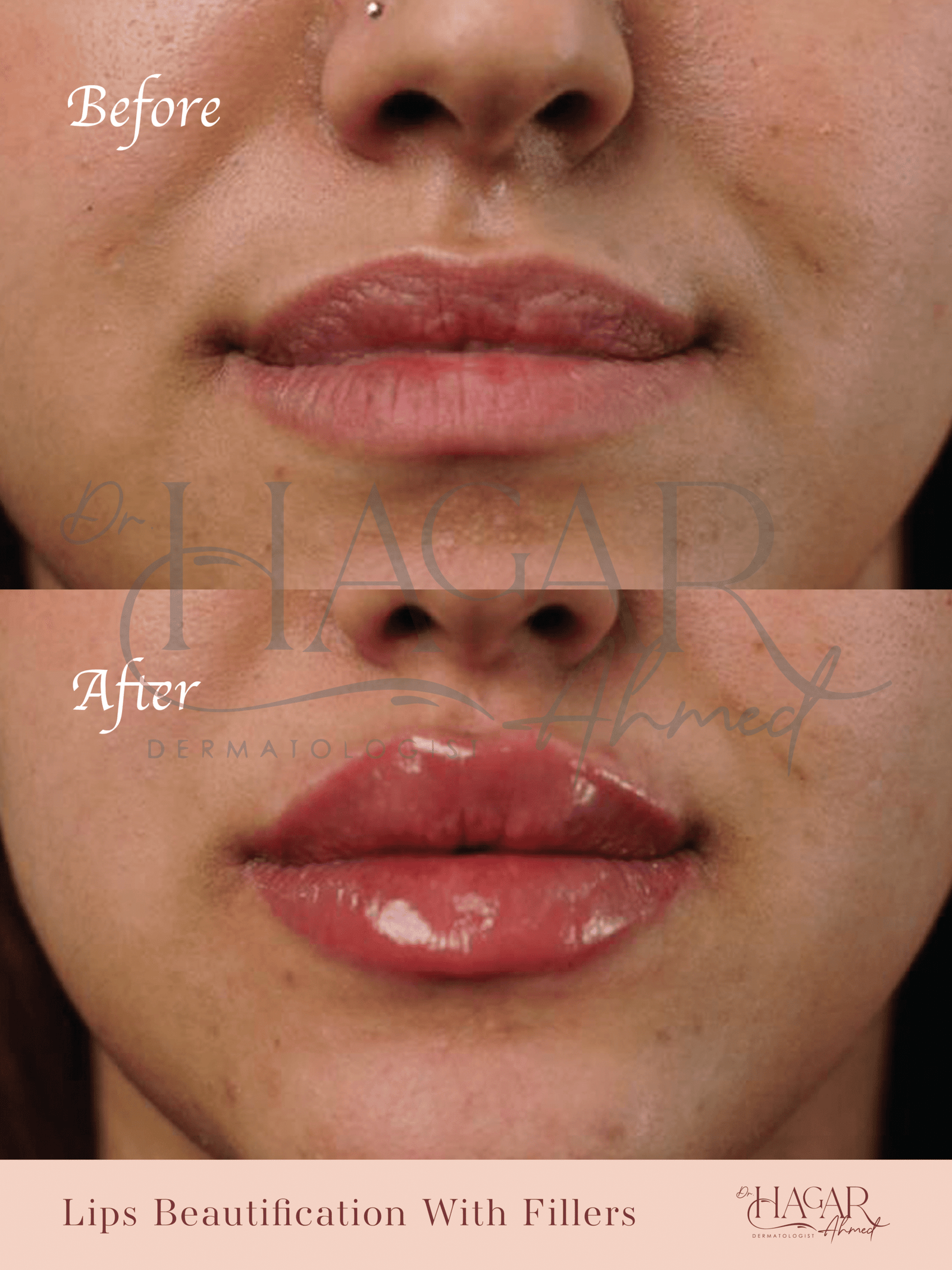 hager-04