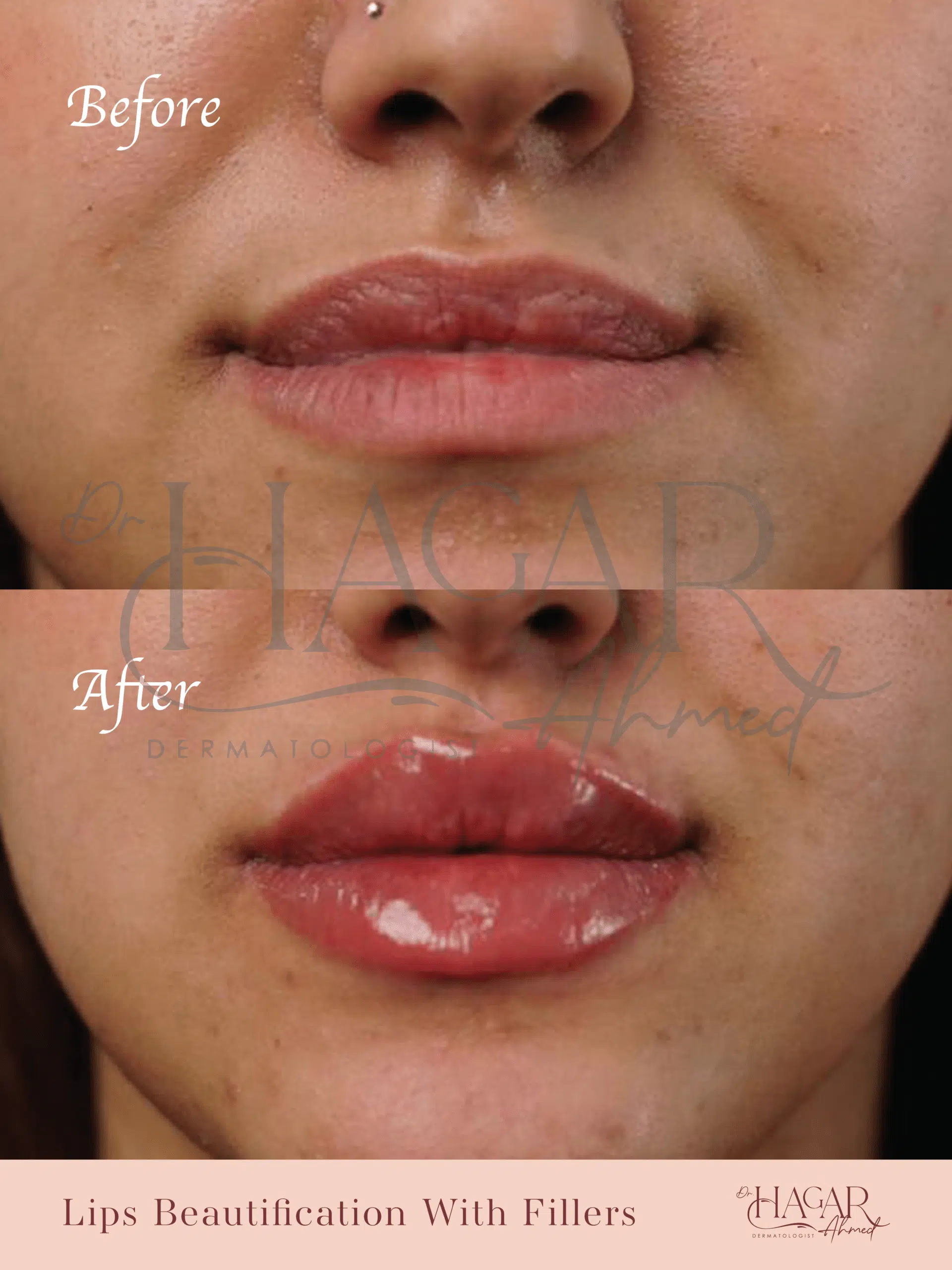 hager-04