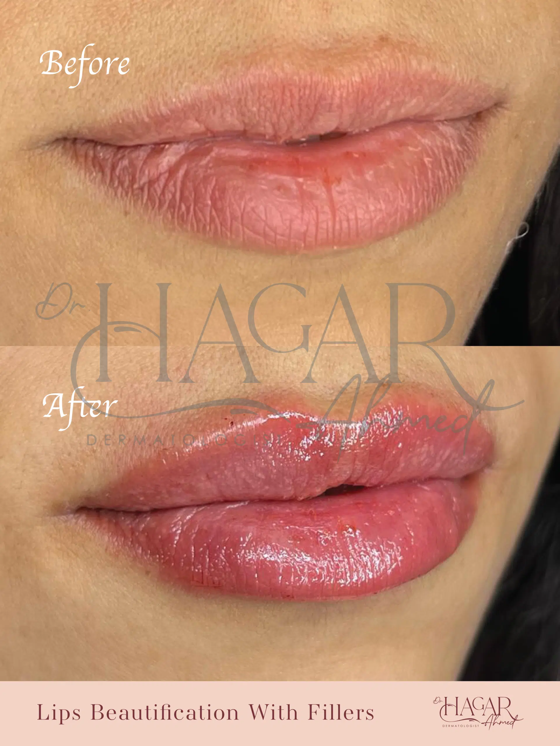 hager-05