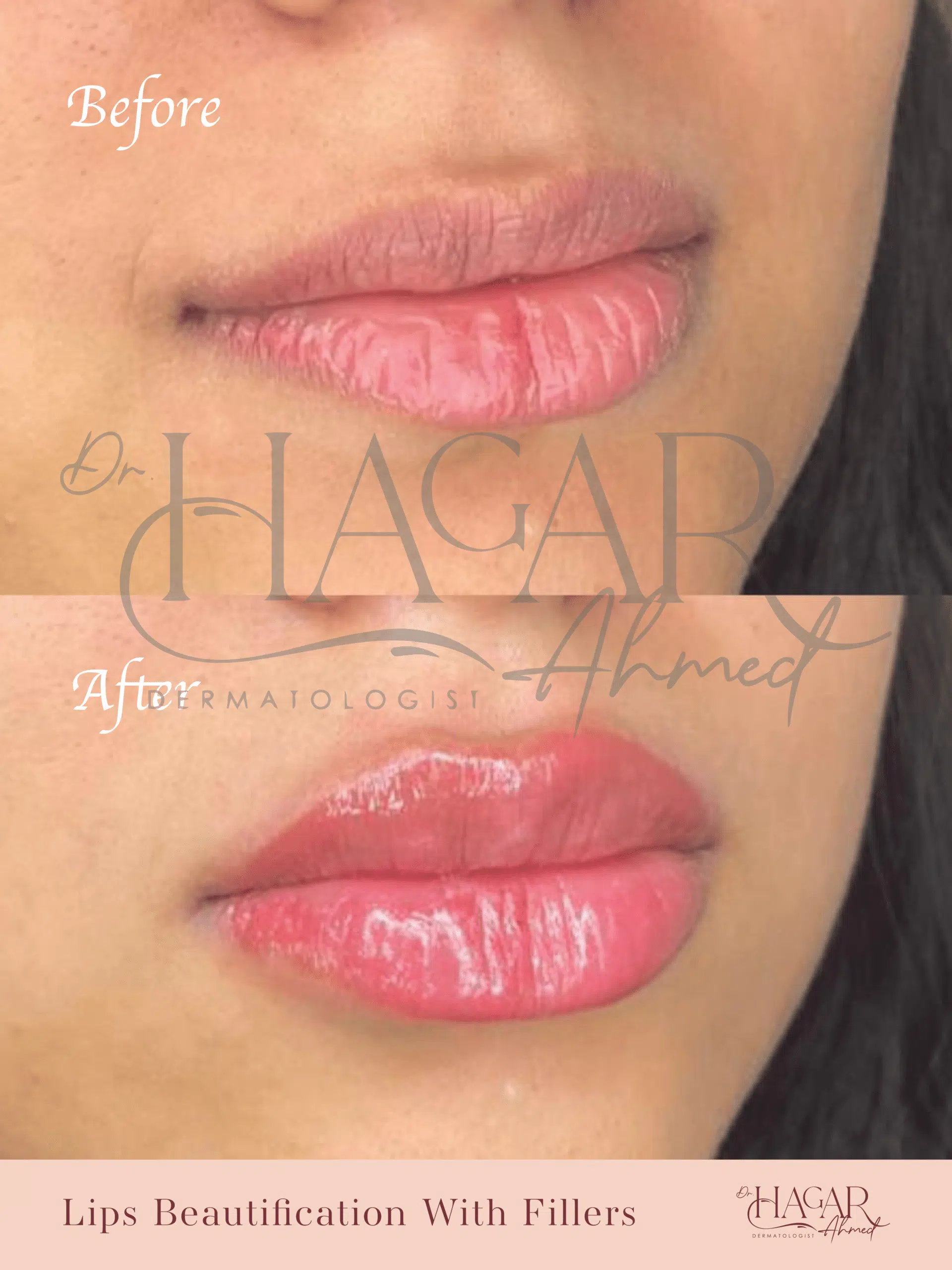 hager-07