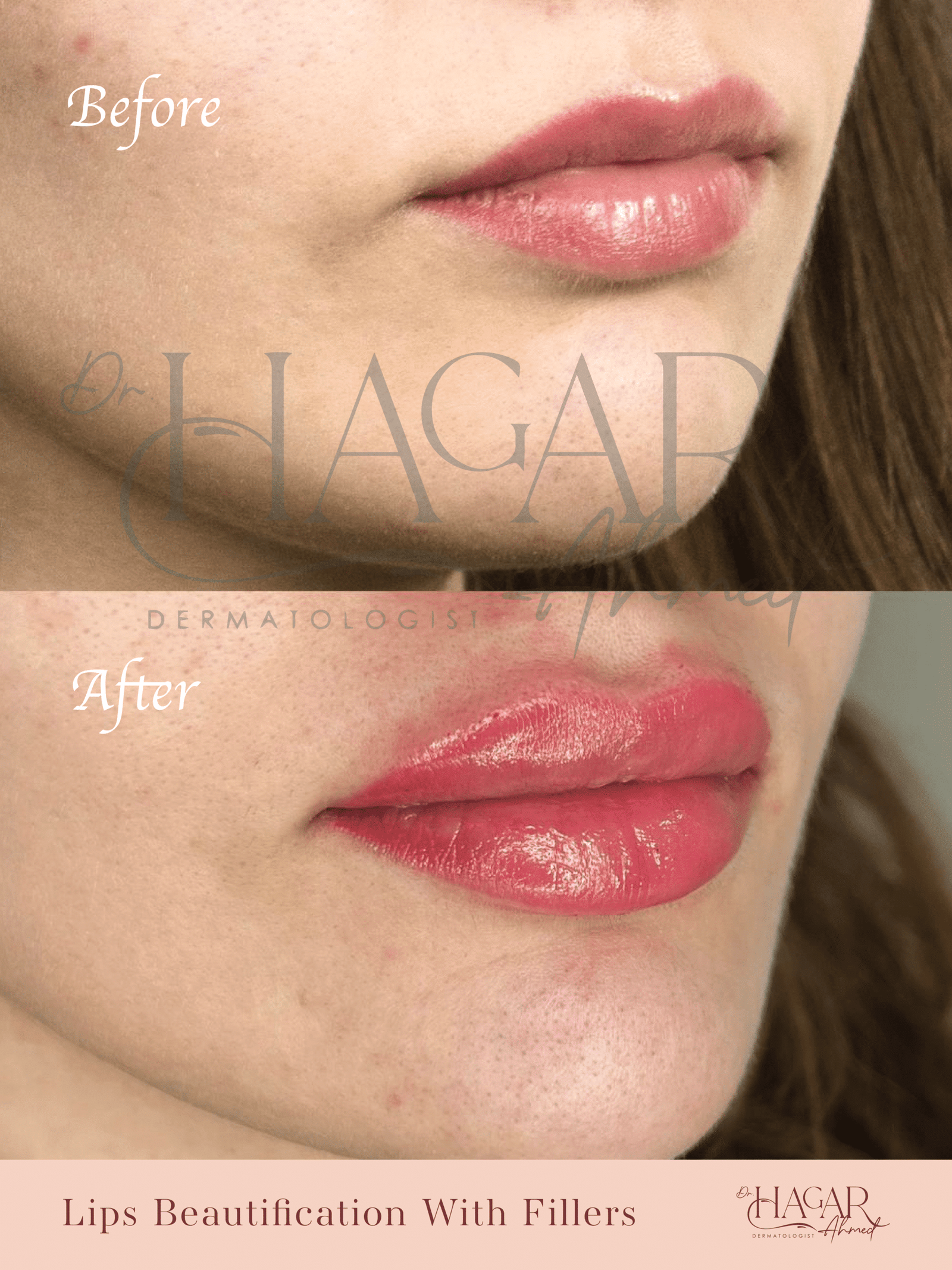 hager-09