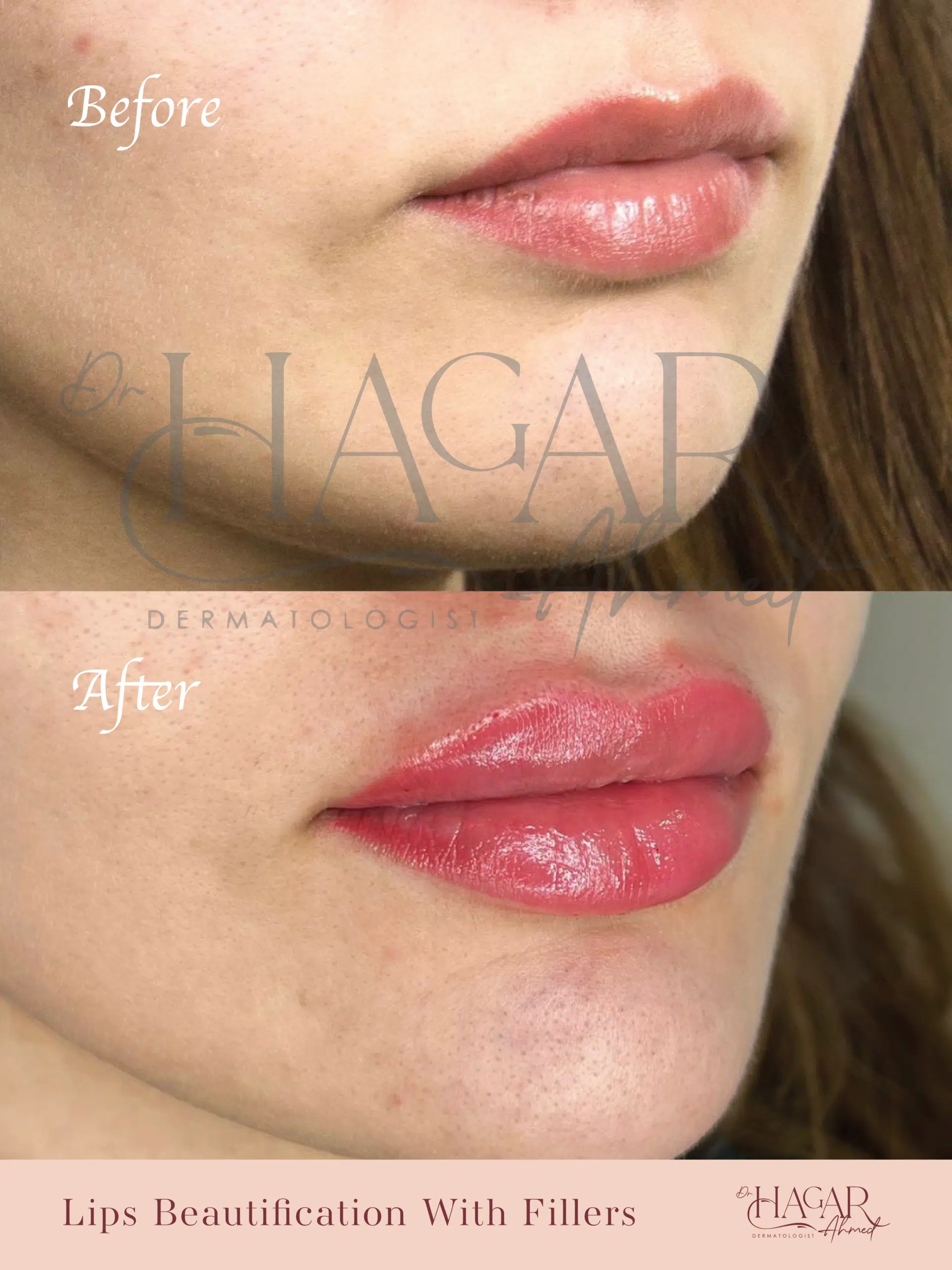 hager-09