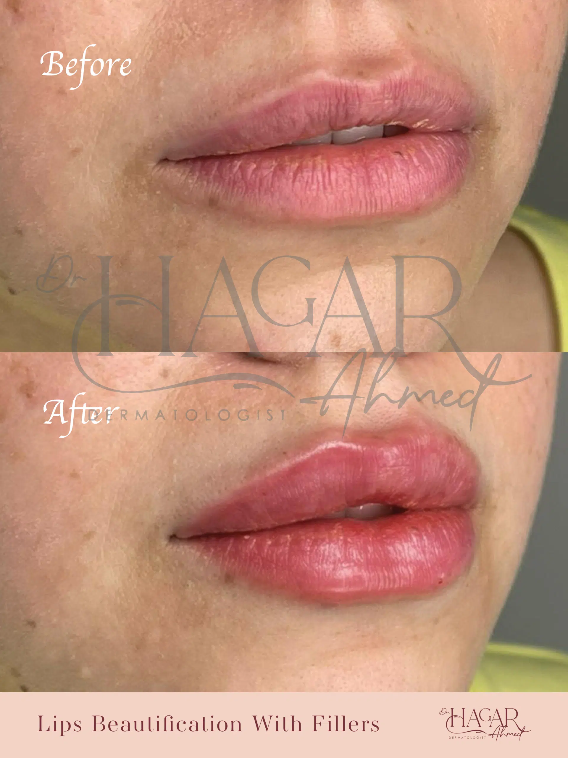 hager-10